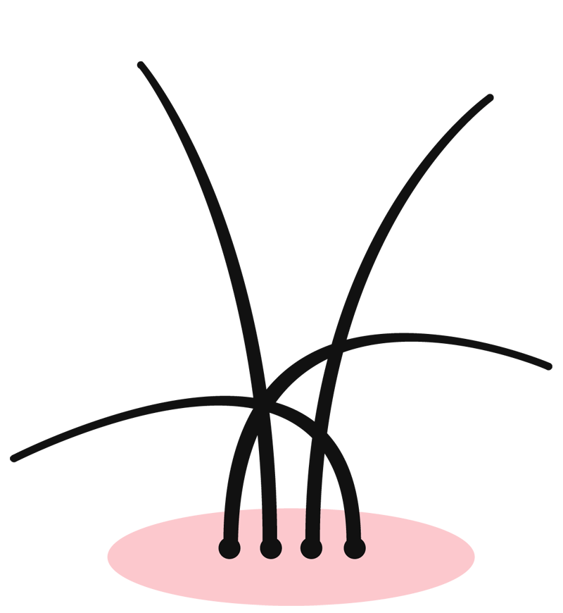 施術前の髪の根元のイラスト